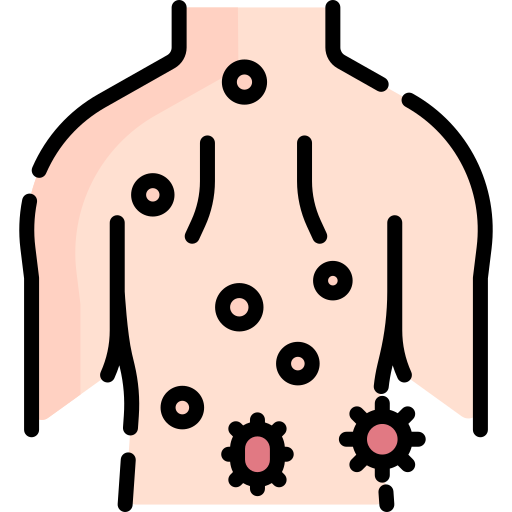 Herpes Zóster - Nervio inflamado o piel con erupción